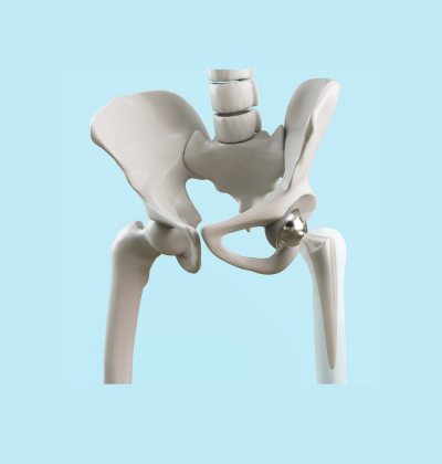 Sports Medicine