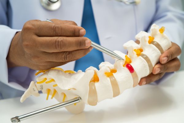 Cervical Spondylitis Treatment