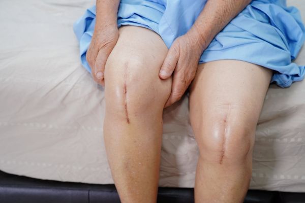 Robotic Knee Replacement Surgery in Navi Mumbai